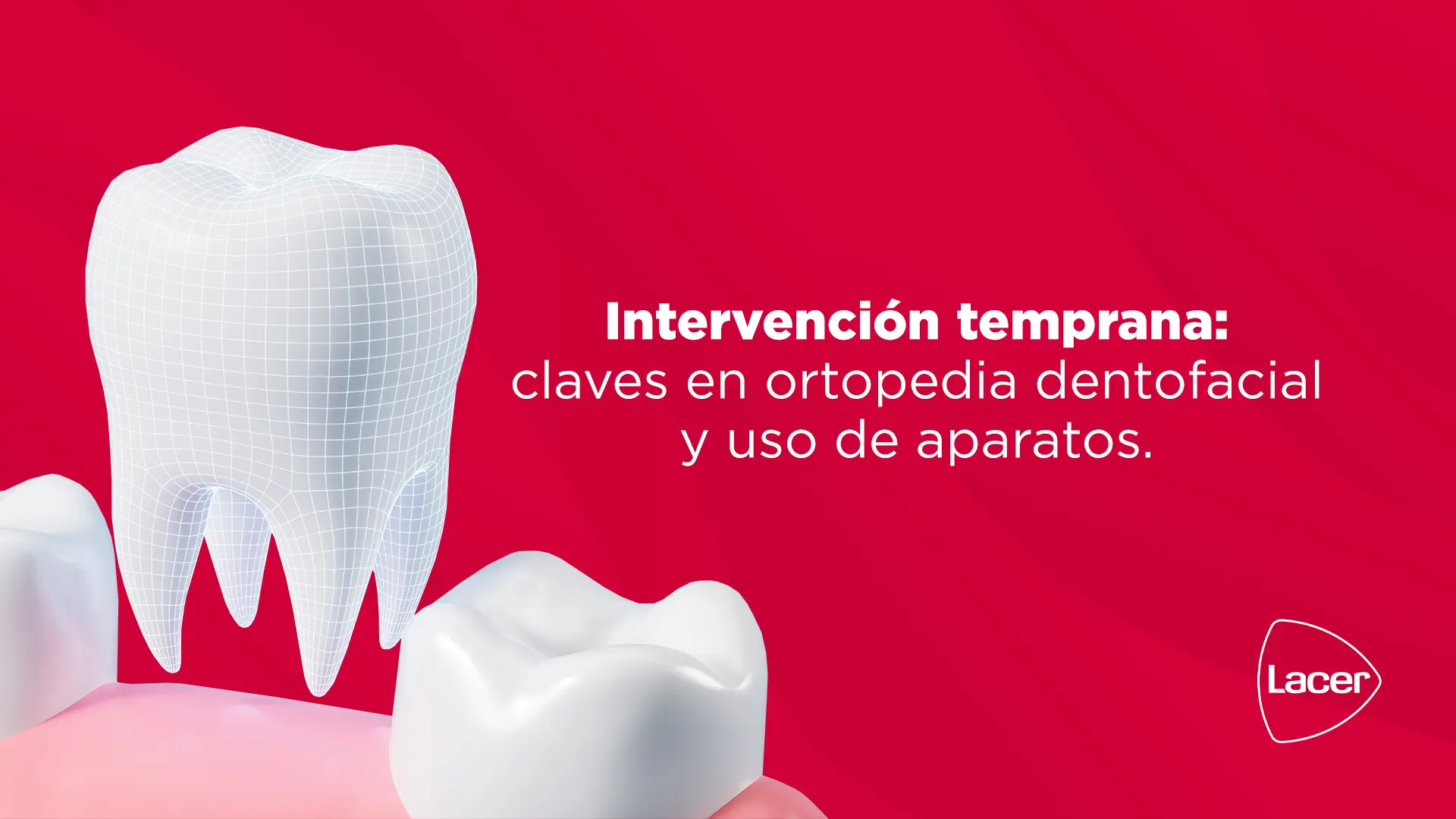 Intervención temprana: claves en ortopedia dentofacial y uso de aparatos